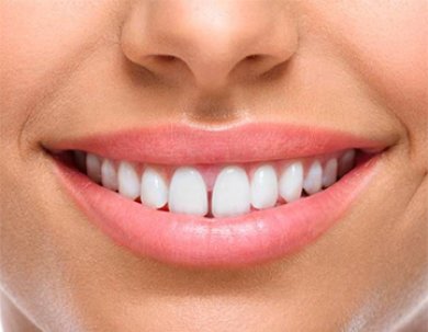 DIASTEMA